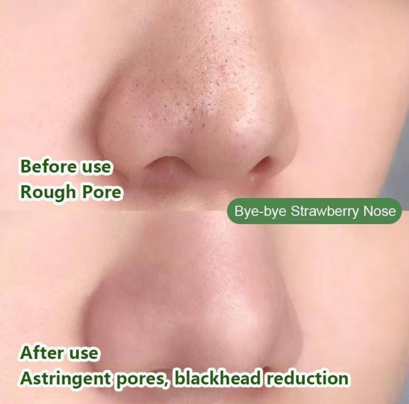 Máscara De Chá Verde Sólida Limpeza Lama Profunda Acne Blackheads Removedor De Óleo Controle Hidratante Melostar